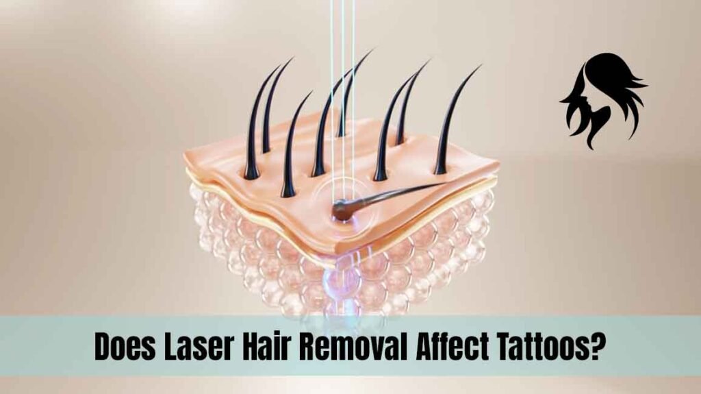 Does Laser Hair Removal Affect Tattoos?